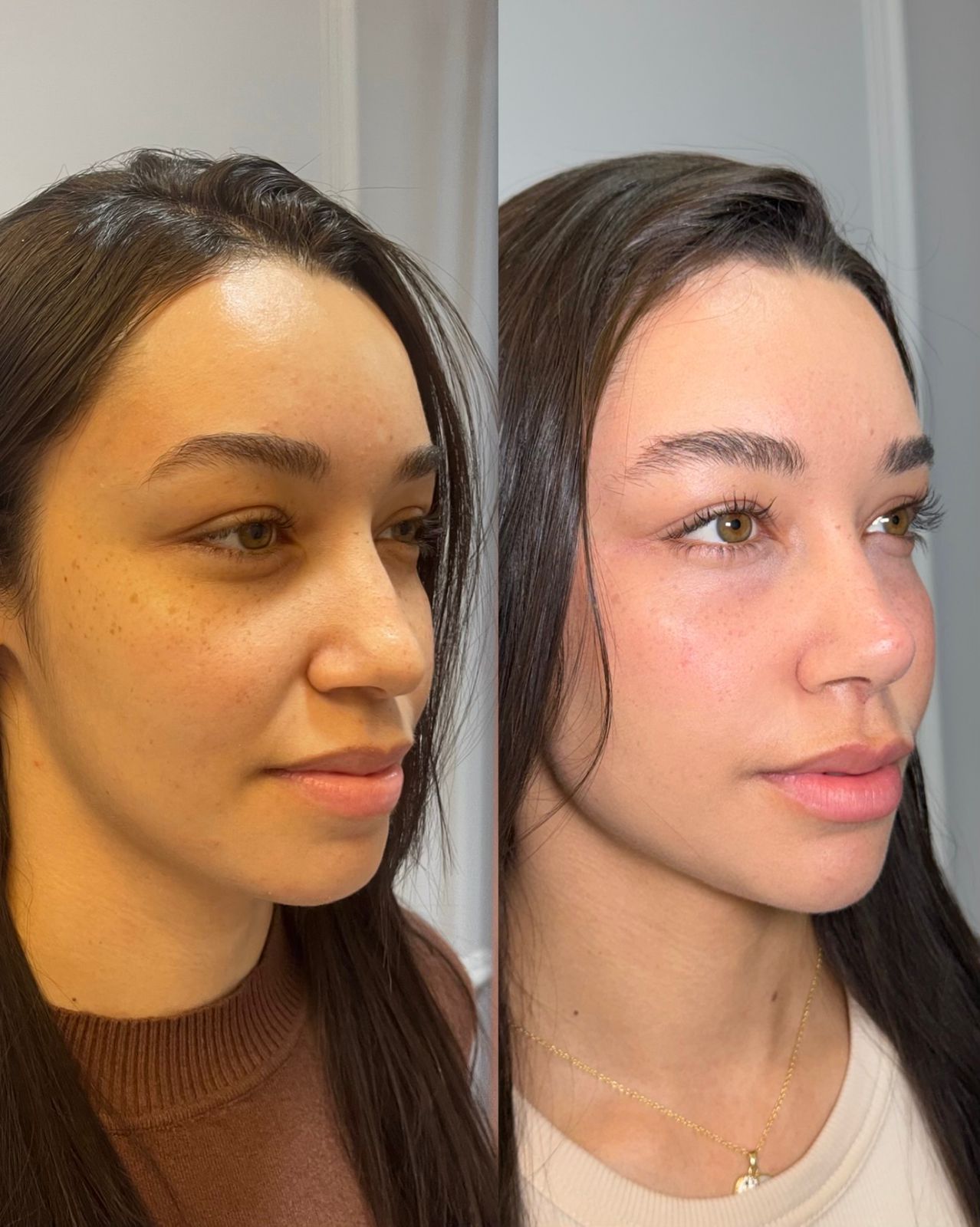 Tratamento facial avançado